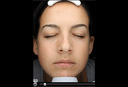 Visia_Advanced Aging Simulation