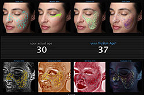 Visia_Skin condition